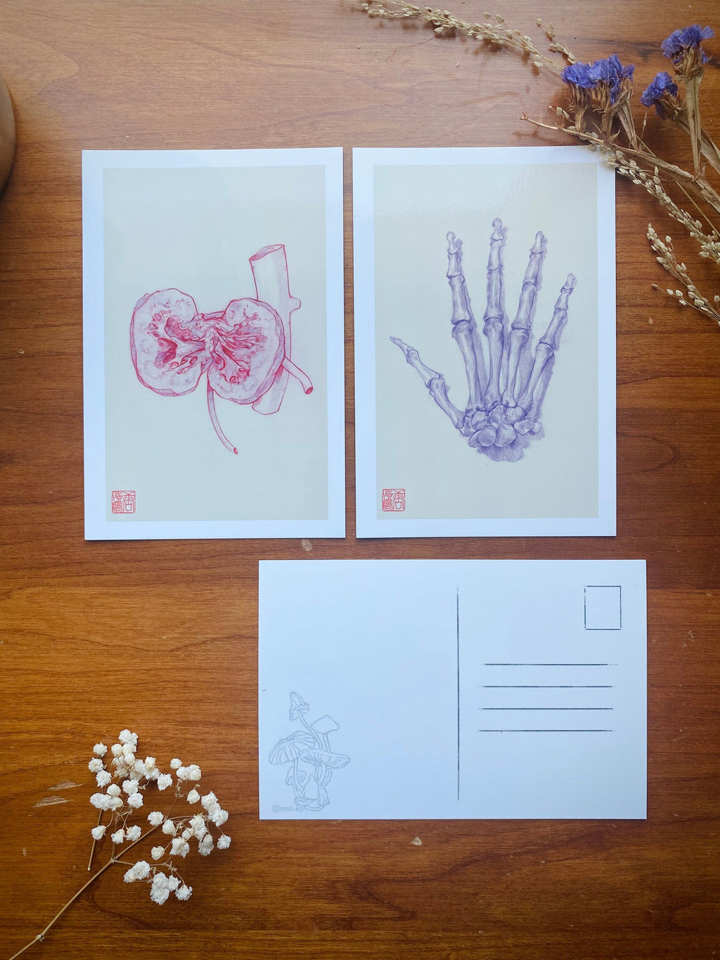 Illustrated postcards · Medical art · Videogame